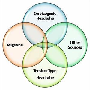 Dhe Migraine Treatment - How To Start Preventing Migraine Headaches - Get Relief Fast