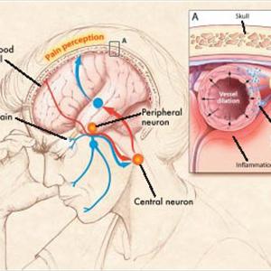 Occipital Migraine Treatment - How To Tell The Differences Among Different Types Of Migraines?