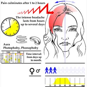 Butterbur Migraines - Common Migraine Symptoms